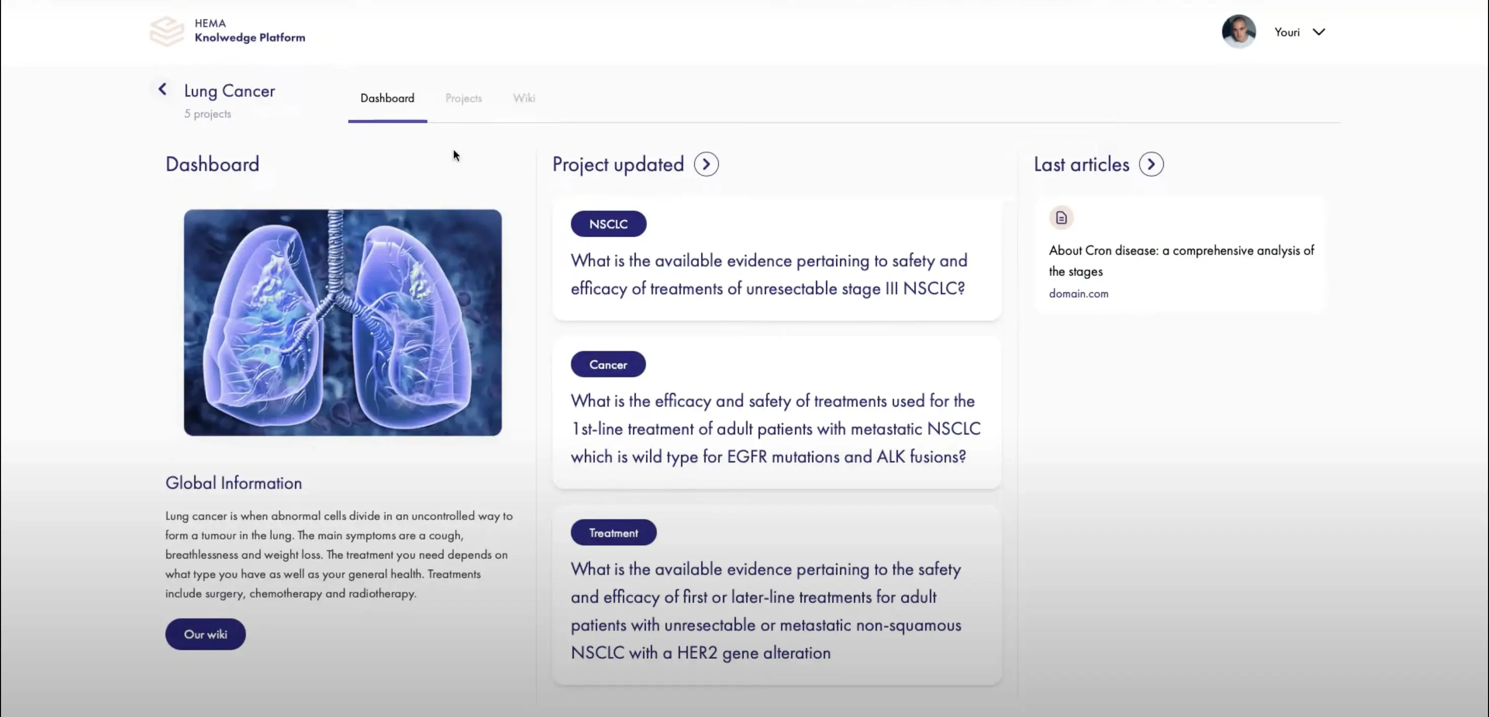 Project preview